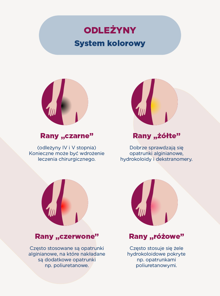 Leczenie odleżyn – system kolorowy