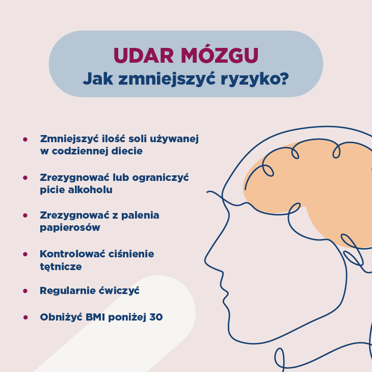 Udar mózgu – jak zmniejszyć ryzyko
